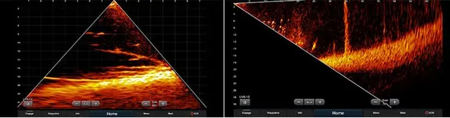 Garmin Panoptix™ LiveScope LVS12 Levande bild under båten, aktermontering 